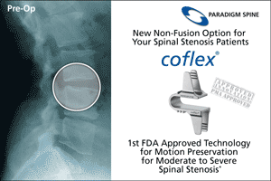 CoFlex spinal implant promotional card